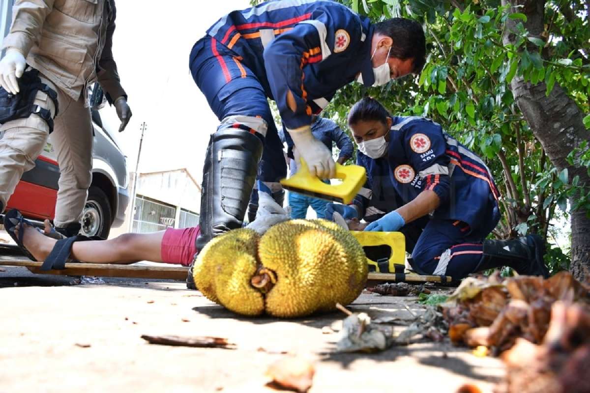 Garoto De Anos Cai De Rvore E Fratura Punho E Rosto Ao Tentar Pegar