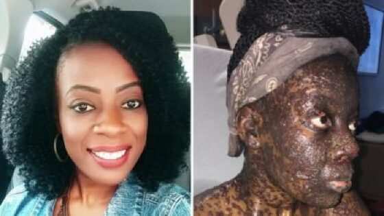 Mulher antes e depois 
