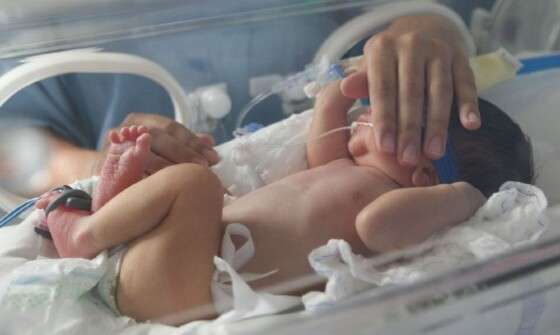 Bebê consegue cirurgia