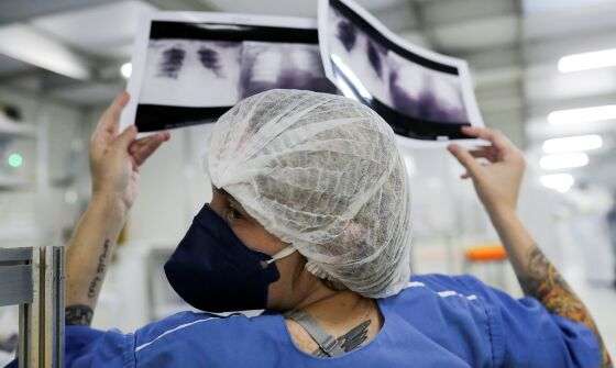 RADIOGRAFIA CORONA
