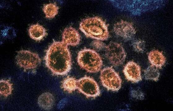 Imagens de microscópio mostram partículas do coronavírus que causam a Covid-19