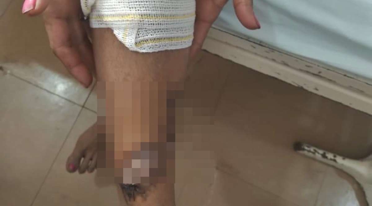 Mulher flagra marido traindo, vai tirar satisfação e é jogada em fogueira |  Única News - Notícias e Fatos com Credibilidade