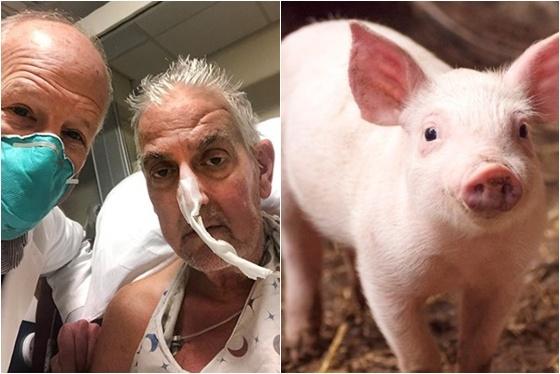 homem transplante coração de porco
