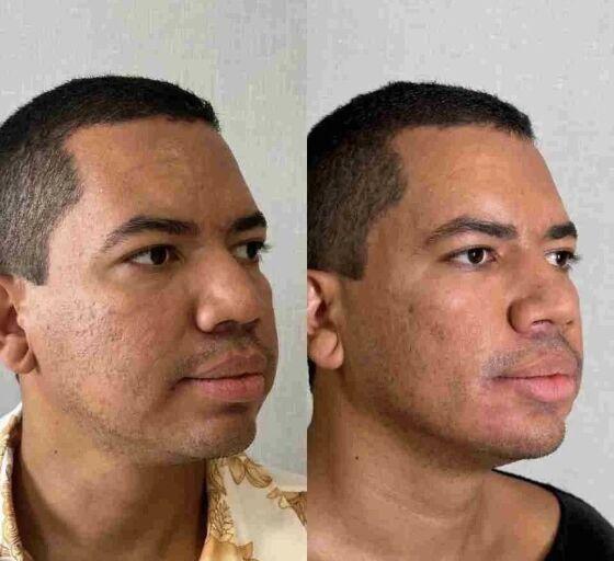 Bruno Gaga