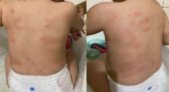 criança agredida em creche Cuiabá