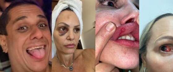 Sanderson Ferreira espancou Débora, que é personal trainer.