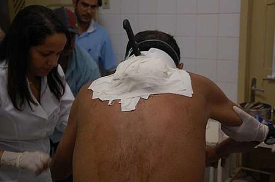 Criminoso crava faca na nuca do atual namorado da ex-mulher em MT